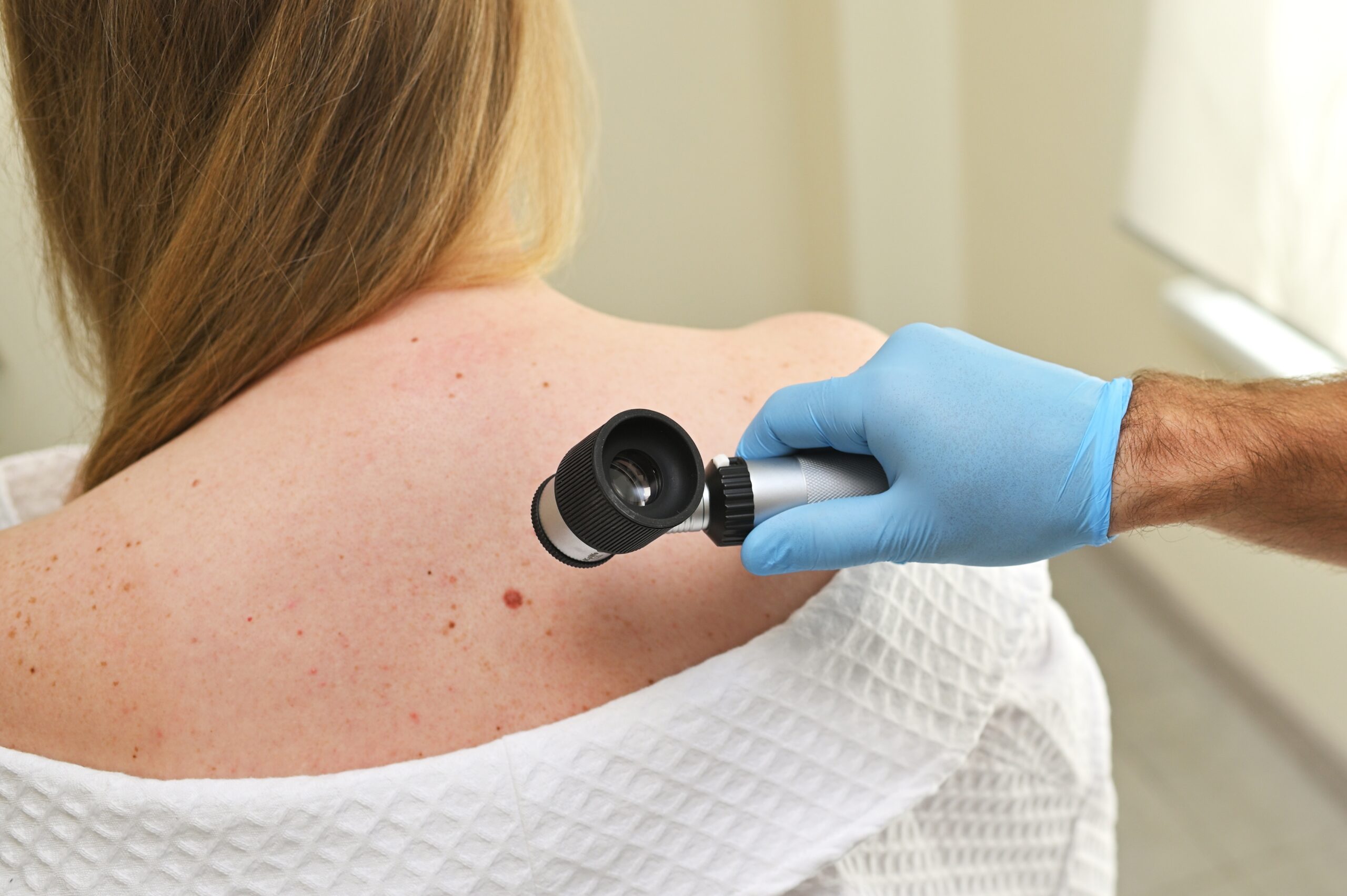 A,Dermatologist,Oncologist,Uses,A,Dermatoscope,To,Examine,Moles,And